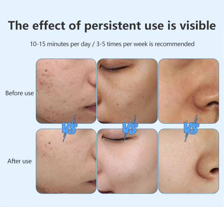 Ledoré AuraMask – LED Multi Light Therapy Mask + FREE GIFT